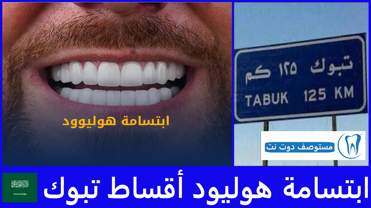 ابتسامة هوليود أقساط تبوك