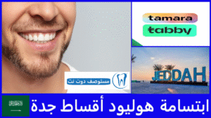 ابتسامة هوليود أقساط جدة