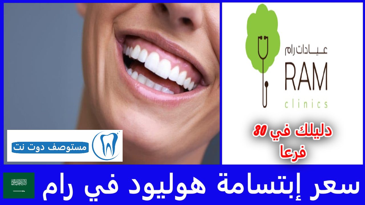 سعر إبتسامة هوليود في رام