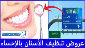 أفضل عروض تنظيف الأسنان بالإحساء