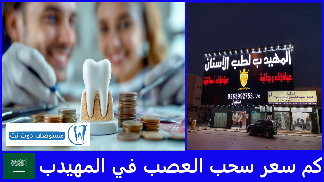 كم سعر سحب العصب في المهيدب