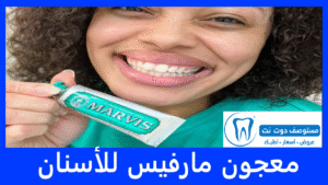 معجون مارفيس للأسنان | الأنواع والأسعار والأضرار مع تجاربكم