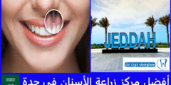 أفضل 10 مركز زراعة الأسنان في جدة وفق آراء المرضى