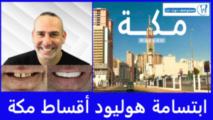 ابتسامة هوليود أقساط مكة 5 عيادات أسنان عليك زيارتها