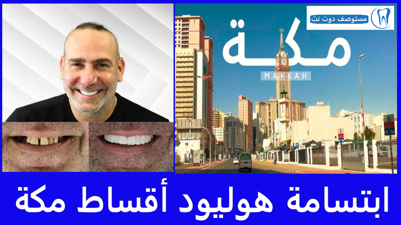 ابتسامة هوليود أقساط مكة 5 عيادات أسنان عليك زيارتها