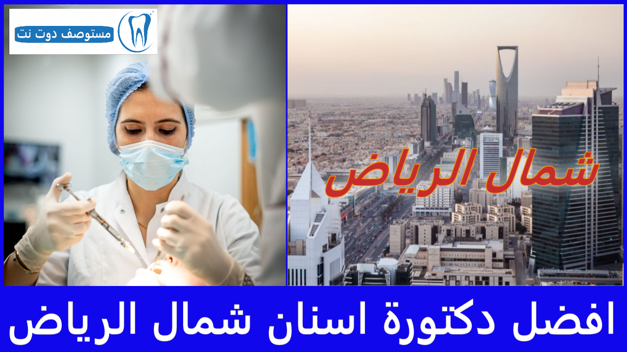 افضل 10 دكتورة اسنان شمال الرياض الأسماء الأكثر ترشيحًا