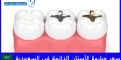 سعر حشوة الأسنان الدائمة في السعودية | عيادات 60% أرخص