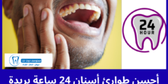 أحسن 5 طوارئ أسنان 24 ساعة بريدة