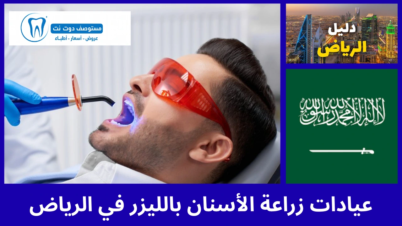 افضل 10 عيادات زراعة الأسنان بالليزر في الرياض