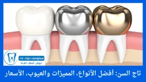 تاج السن: أفضل الأنواع، المميزات والعيوب، الأسعار