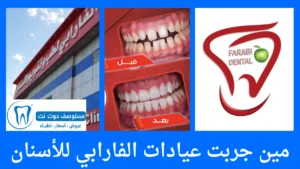 مين جربت عيادات الفارابي للأسنان؟ تجارب حقيقية وآراء المرضى