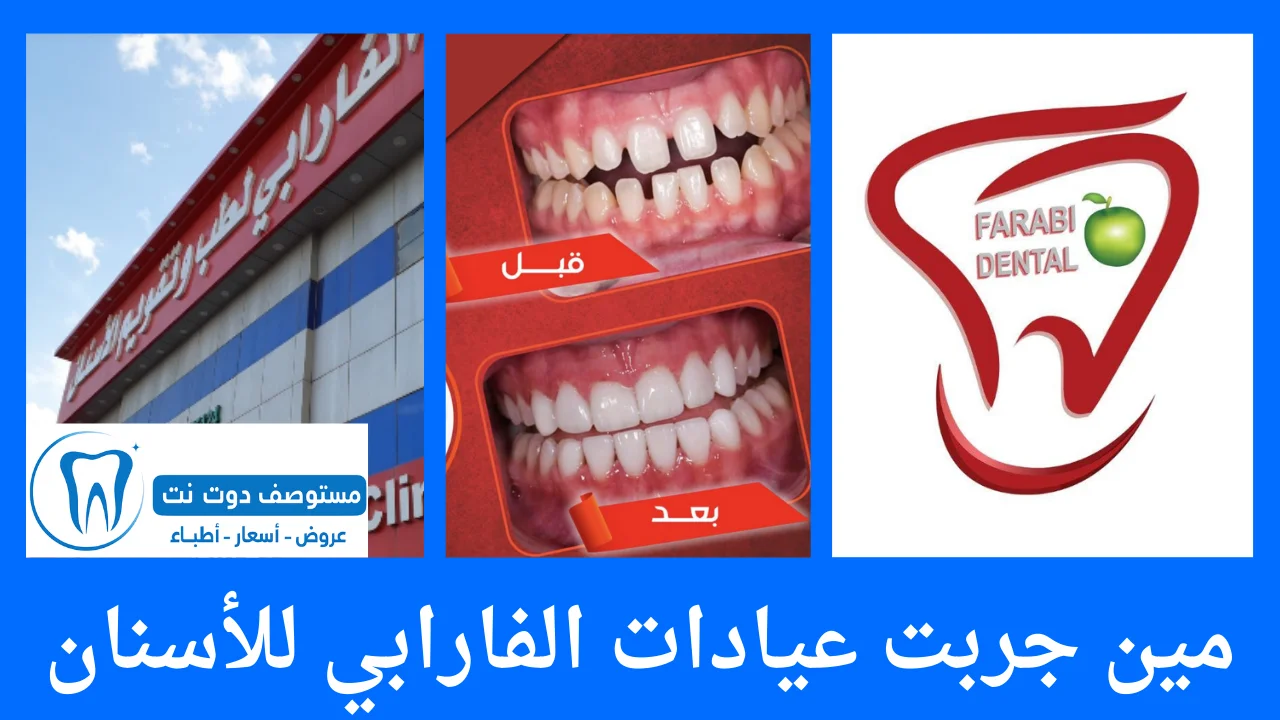 مين جربت عيادات الفارابي للأسنان؟ تجارب حقيقية وآراء المرضى