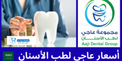 أسعار عاجي لطب الأسنان – أرخص 3 خدمات