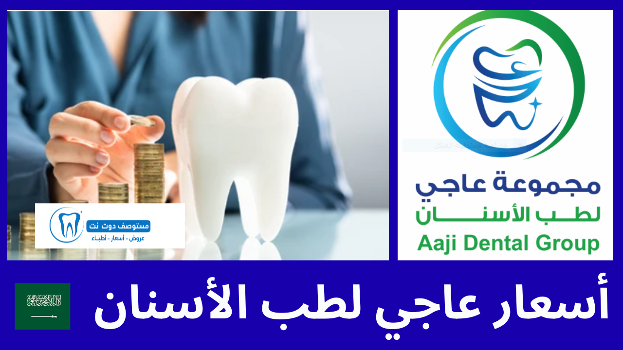أسعار عاجي لطب الأسنان