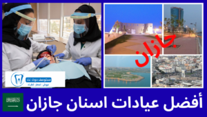 أفضل 10 عيادات اسنان جازان من ناحية الأسعار والتقييمات